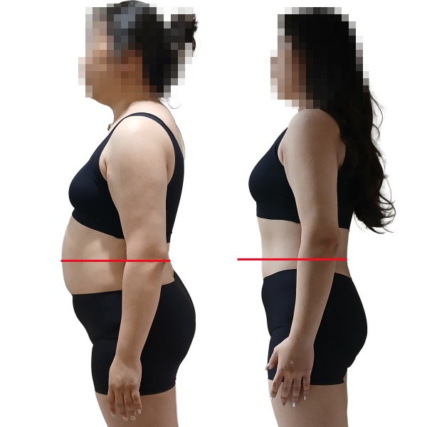 [수원영통] 아이 엄마 맞으세요? 2달만에 20kg 감량 실화!