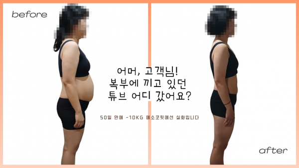 [에소코핏 영통직영점] 어머, 고객님 ! 복부에 끼고 있던 튜브 어디 갔어요?